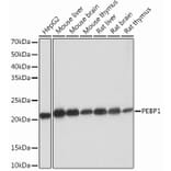 Western Blot - Anti-RKIP Antibody [ARC0704] (A307652) - Antibodies.com
