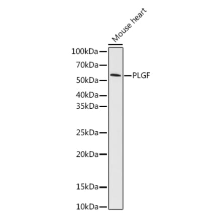 Western Blot - Anti-PLGF Antibody [ARC0749] (A307653) - Antibodies.com