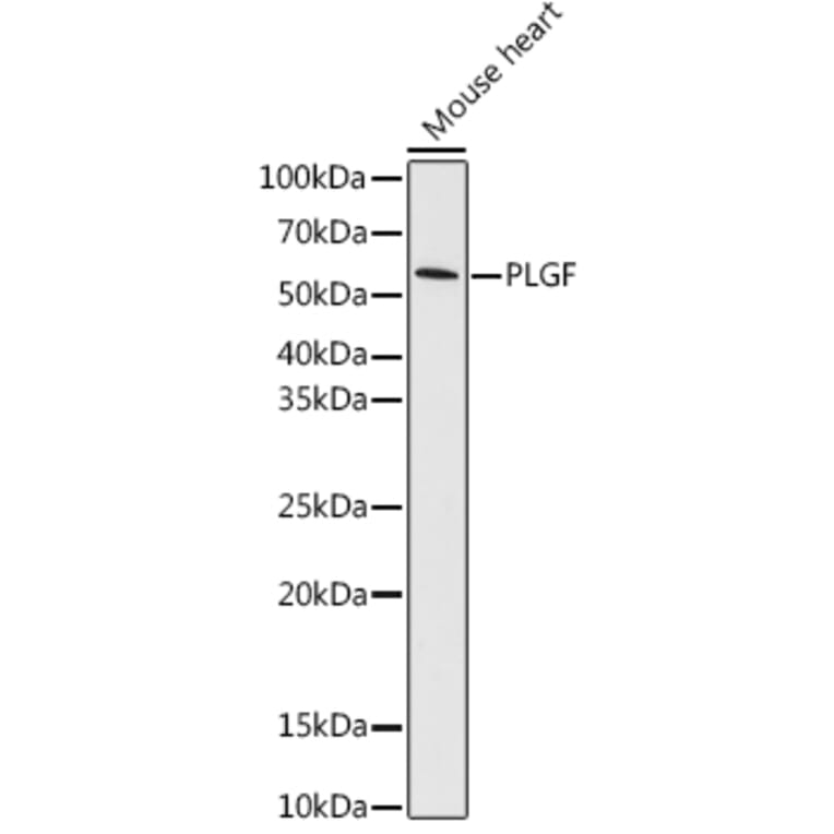 Western Blot - Anti-PLGF Antibody [ARC0749] (A307653) - Antibodies.com