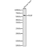 Western Blot - Anti-PLGF Antibody [ARC0749] (A307653) - Antibodies.com