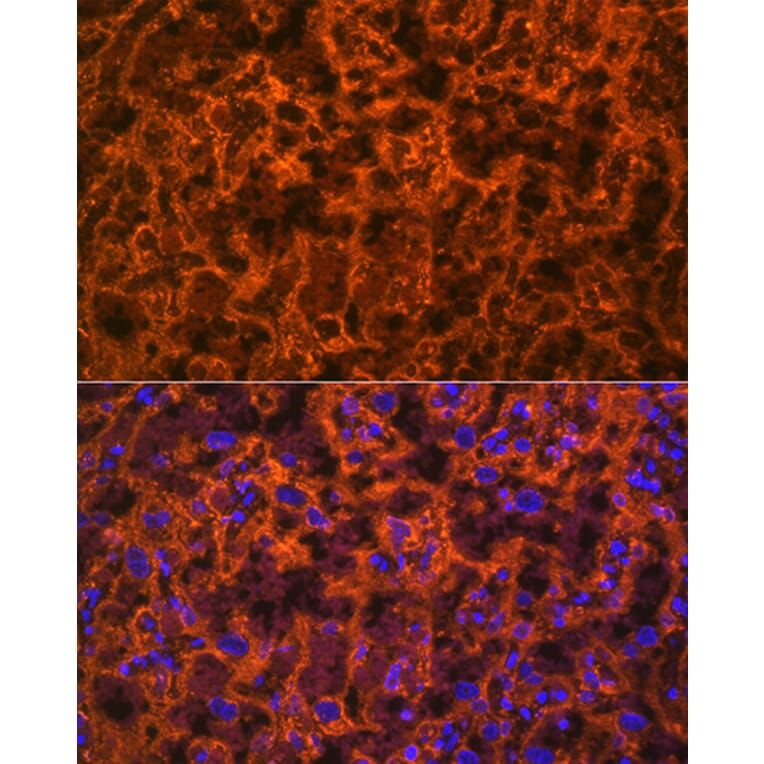 Immunofluorescence - Anti-PLGF Antibody [ARC0749] (A307653) - Antibodies.com