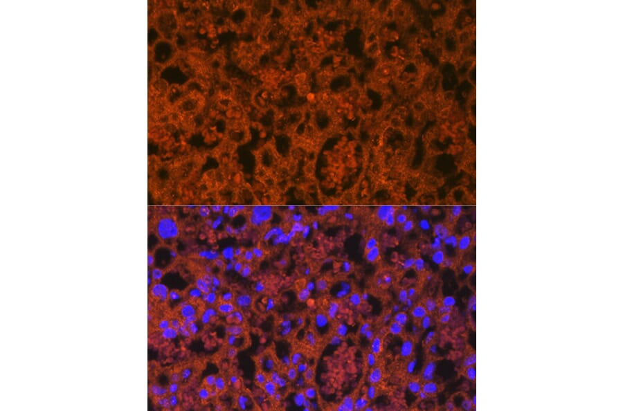 Immunofluorescence - Anti-PLGF Antibody [ARC0749] (A307653) - Antibodies.com