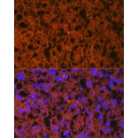 Immunofluorescence - Anti-PLGF Antibody [ARC0749] (A307653) - Antibodies.com