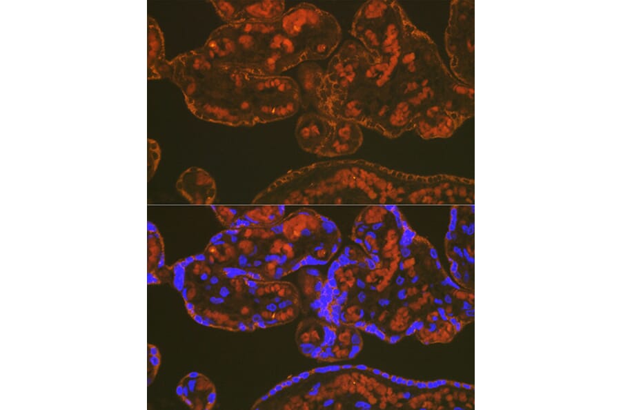 Immunofluorescence - Anti-PLGF Antibody [ARC0749] (A307653) - Antibodies.com