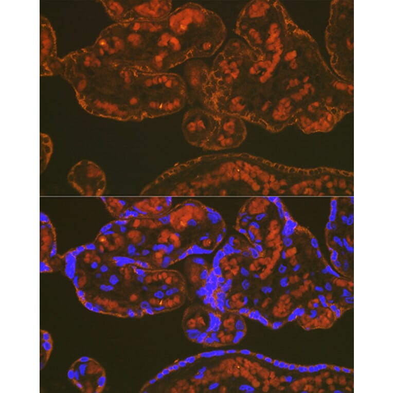 Immunofluorescence - Anti-PLGF Antibody [ARC0749] (A307653) - Antibodies.com