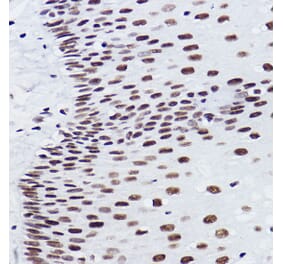 Immunohistochemistry - Anti-BRMS1 Antibody [ARC2536] (A307654) - Antibodies.com