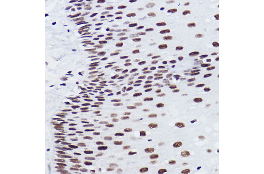 Immunohistochemistry - Anti-BRMS1 Antibody [ARC2536] (A307654) - Antibodies.com