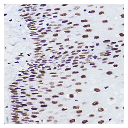 Immunohistochemistry - Anti-BRMS1 Antibody [ARC2536] (A307654) - Antibodies.com