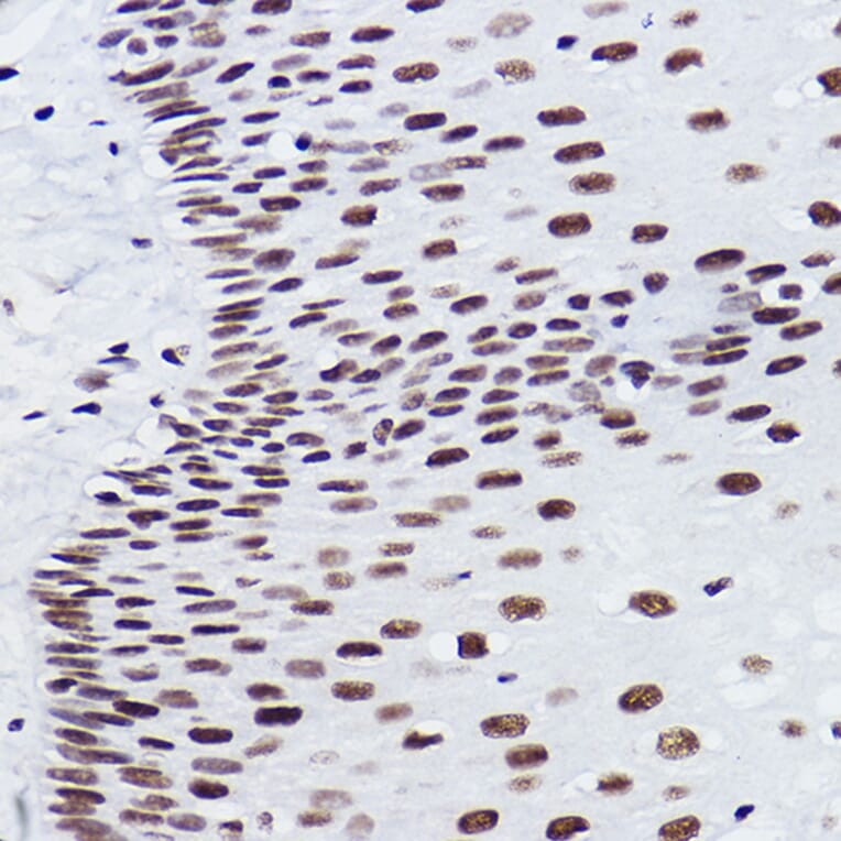 Immunohistochemistry - Anti-BRMS1 Antibody [ARC2536] (A307654) - Antibodies.com