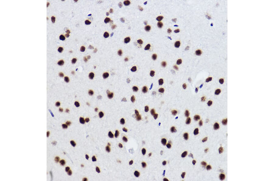 Immunohistochemistry - Anti-BRMS1 Antibody [ARC2536] (A307654) - Antibodies.com