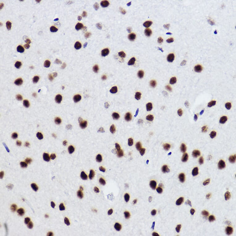 Immunohistochemistry - Anti-BRMS1 Antibody [ARC2536] (A307654) - Antibodies.com