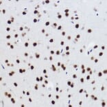 Immunohistochemistry - Anti-BRMS1 Antibody [ARC2536] (A307654) - Antibodies.com