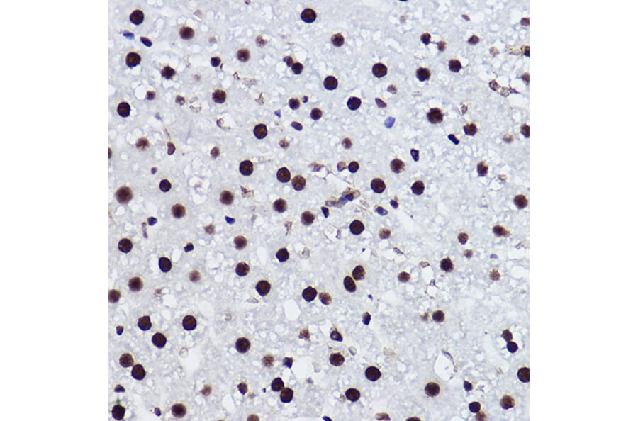 Immunohistochemistry - Anti-BRMS1 Antibody [ARC2536] (A307654) - Antibodies.com