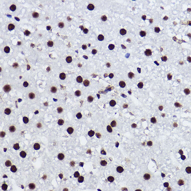 Immunohistochemistry - Anti-BRMS1 Antibody [ARC2536] (A307654) - Antibodies.com