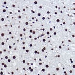 Immunohistochemistry - Anti-BRMS1 Antibody [ARC2536] (A307654) - Antibodies.com