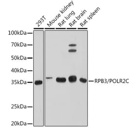 Western Blot - Anti-RPB3 Antibody [ARC1729] (A307655) - Antibodies.com