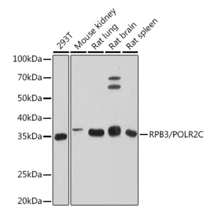 Western Blot - Anti-RPB3 Antibody [ARC1729] (A307655) - Antibodies.com