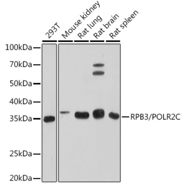 Western Blot - Anti-RPB3 Antibody [ARC1729] (A307655) - Antibodies.com