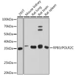 Western Blot - Anti-RPB3 Antibody [ARC1729] (A307655) - Antibodies.com