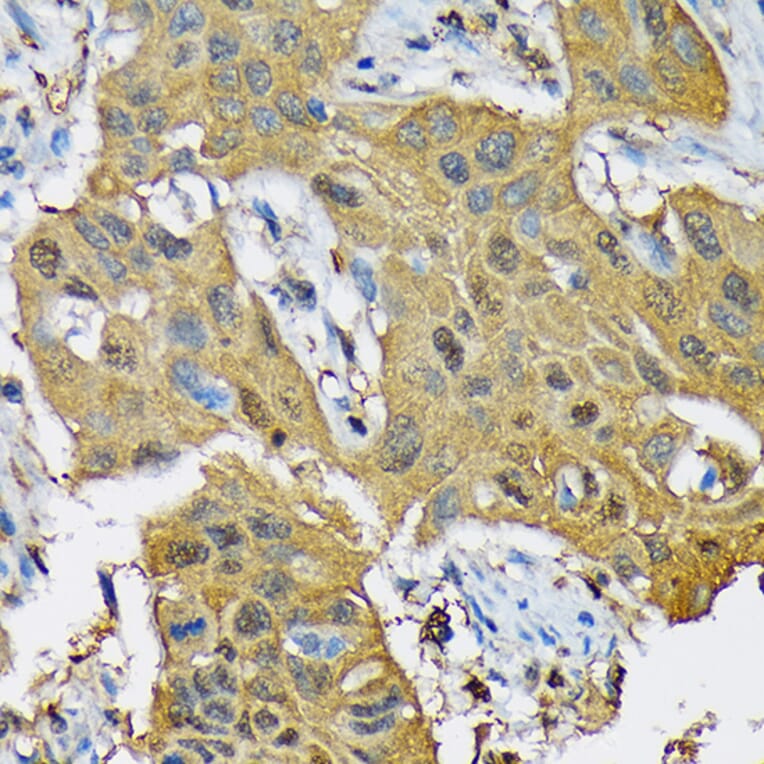 Immunohistochemistry - Anti-RPB3 Antibody [ARC1729] (A307655) - Antibodies.com