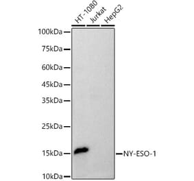 Western Blot - Anti-CTAG1B Antibody [ARC52780] (A307657) - Antibodies.com