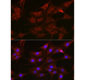 Immunofluorescence - Anti-Rac1 Antibody (A307659) - Antibodies.com