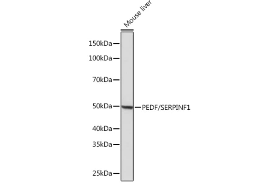Western Blot - Anti-PEDF Antibody [ARC0784] (A307661) - Antibodies.com