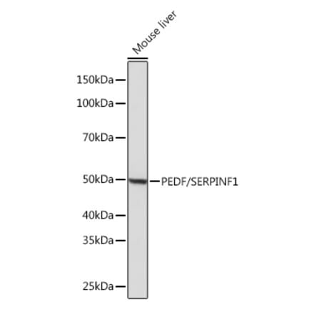 Western Blot - Anti-PEDF Antibody [ARC0784] (A307661) - Antibodies.com