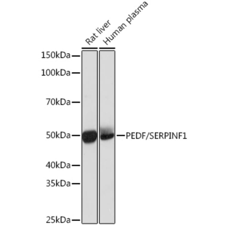 Western Blot - Anti-PEDF Antibody [ARC0784] (A307661) - Antibodies.com