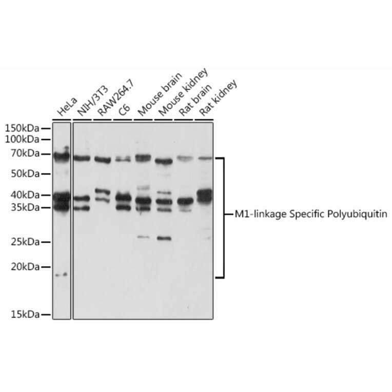 Western Blot - Anti-M1-linkage specific Polyubiquitin Antibody (A307664) - Antibodies.com