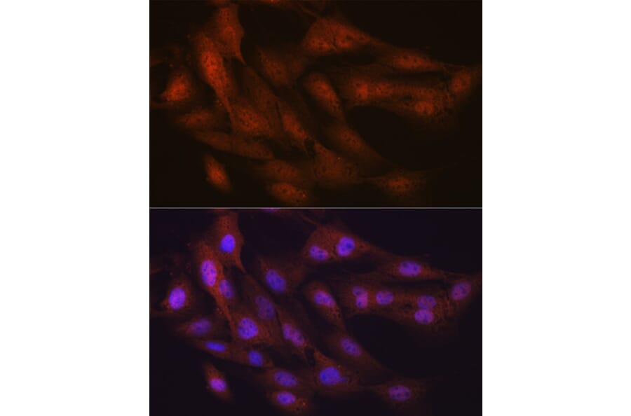 Immunofluorescence - Anti-K48-linkage specific Ubiquitin Antibody [ARC0811] (A307665) - Antibodies.com