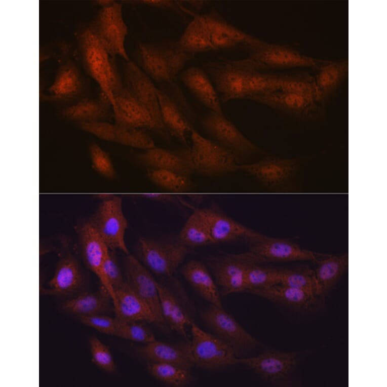 Immunofluorescence - Anti-K48-linkage specific Ubiquitin Antibody [ARC0811] (A307665) - Antibodies.com