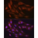 Immunofluorescence - Anti-K48-linkage specific Ubiquitin Antibody [ARC0811] (A307665) - Antibodies.com
