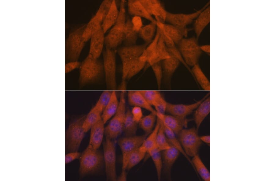 Immunofluorescence - Anti-K48-linkage specific Ubiquitin Antibody [ARC0811] (A307665) - Antibodies.com
