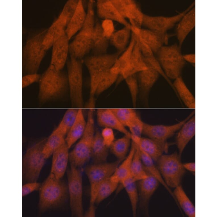 Immunofluorescence - Anti-K48-linkage specific Ubiquitin Antibody [ARC0811] (A307665) - Antibodies.com