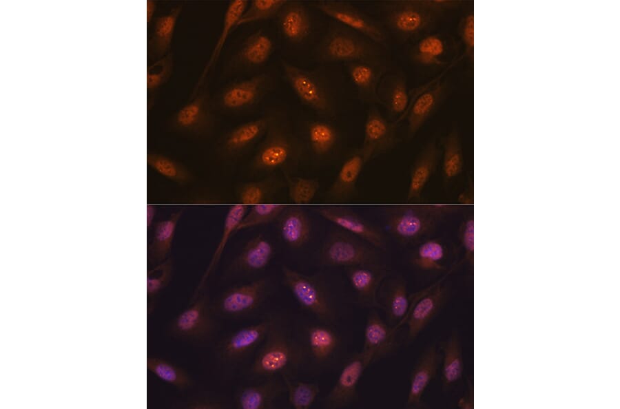 Immunofluorescence - Anti-K48-linkage specific Ubiquitin Antibody [ARC0811] (A307665) - Antibodies.com