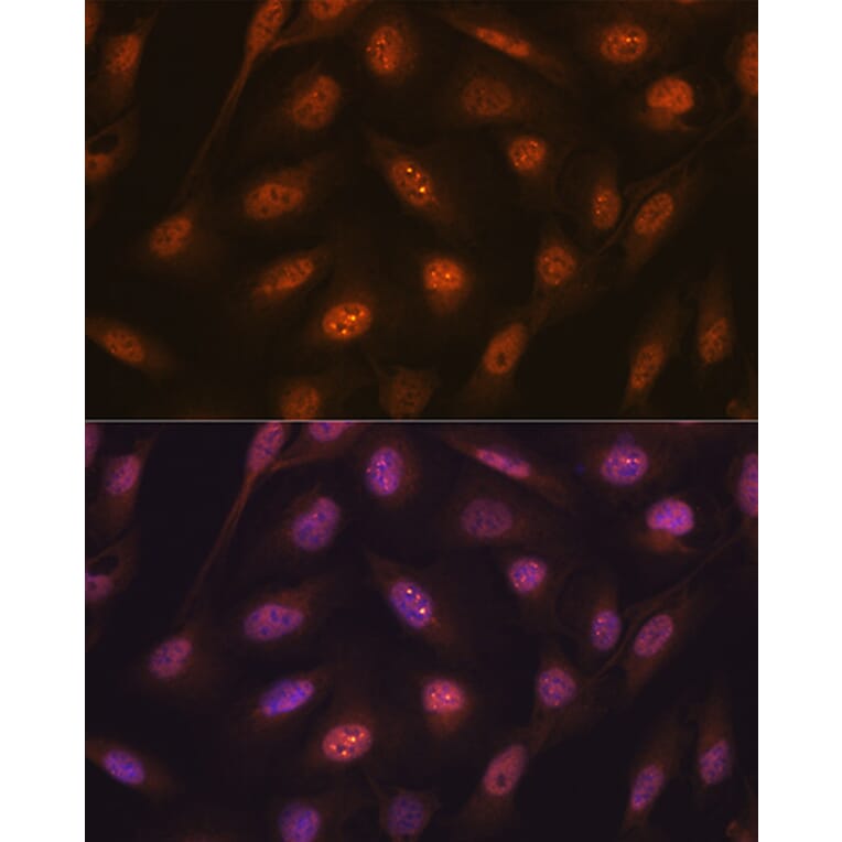 Immunofluorescence - Anti-K48-linkage specific Ubiquitin Antibody [ARC0811] (A307665) - Antibodies.com