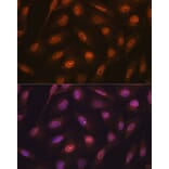 Immunofluorescence - Anti-K48-linkage specific Ubiquitin Antibody [ARC0811] (A307665) - Antibodies.com