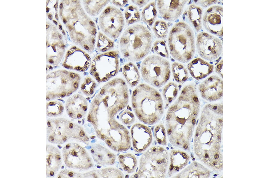 Immunohistochemistry - Anti-Ubiquitin Antibody [ARC50024] (A307666) - Antibodies.com