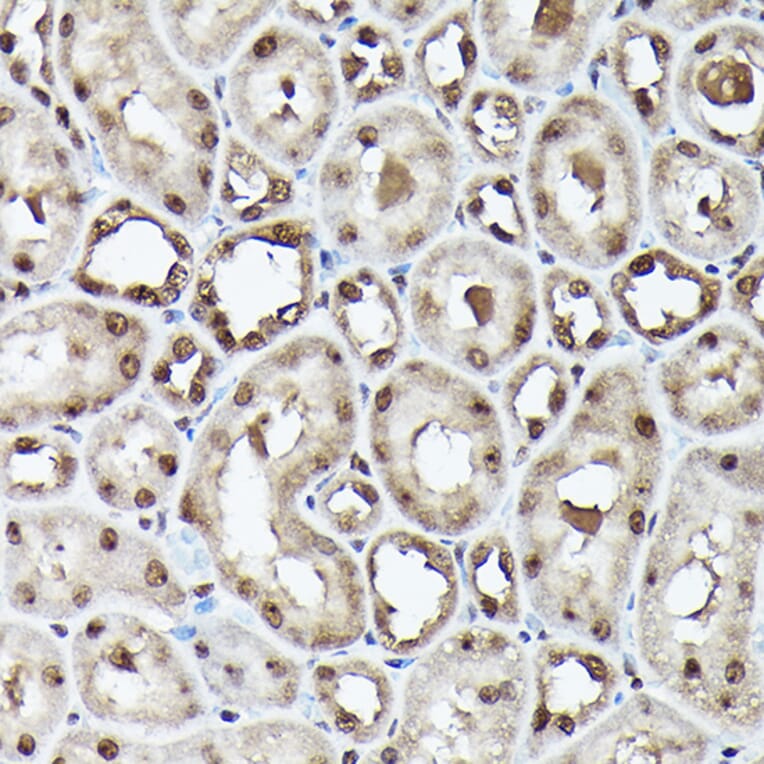 Immunohistochemistry - Anti-Ubiquitin Antibody [ARC50024] (A307666) - Antibodies.com
