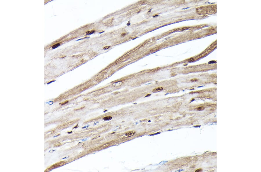 Immunohistochemistry - Anti-Ubiquitin Antibody [ARC50024] (A307666) - Antibodies.com