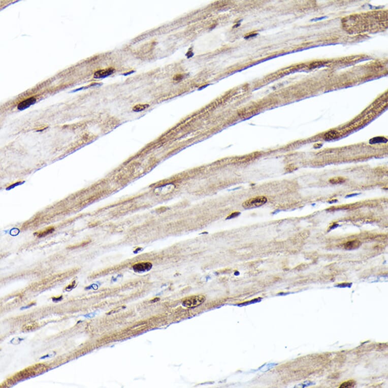 Immunohistochemistry - Anti-Ubiquitin Antibody [ARC50024] (A307666) - Antibodies.com