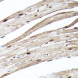 Immunohistochemistry - Anti-Ubiquitin Antibody [ARC50024] (A307666) - Antibodies.com