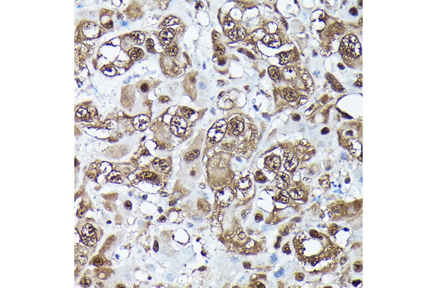 Immunohistochemistry - Anti-Ubiquitin Antibody [ARC50024] (A307666) - Antibodies.com