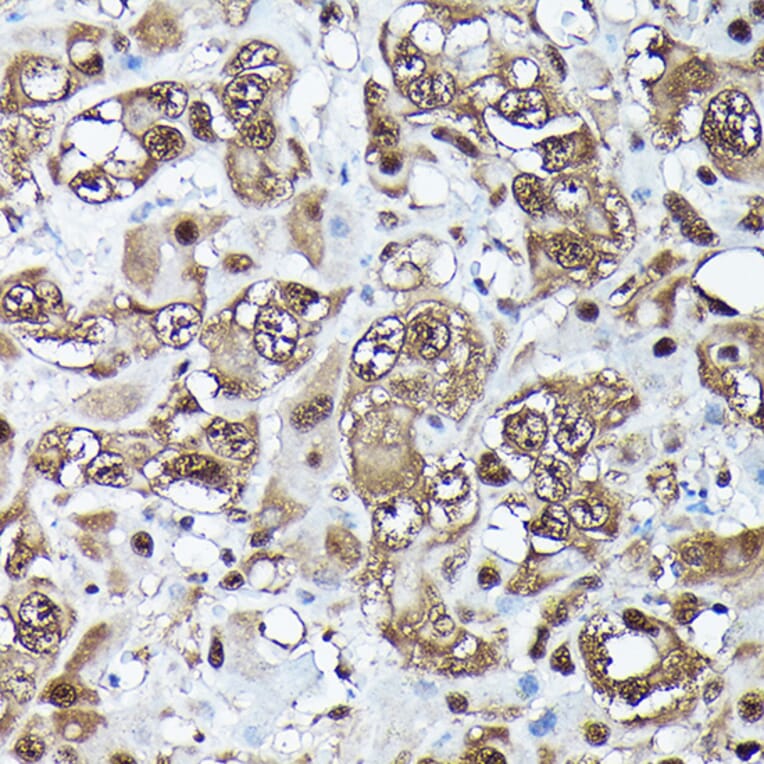 Immunohistochemistry - Anti-Ubiquitin Antibody [ARC50024] (A307666) - Antibodies.com