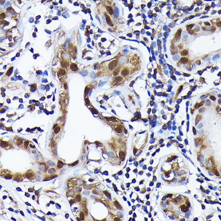 Immunohistochemistry - Anti-Ubiquitin Antibody [ARC50024] (A307666) - Antibodies.com