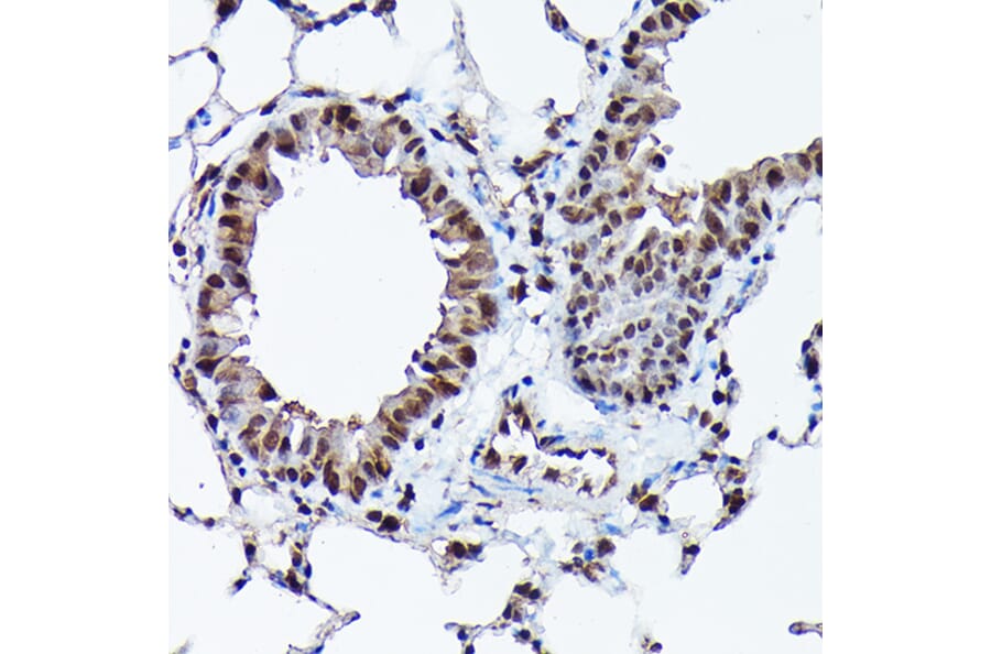 Immunohistochemistry - Anti-Ubiquitin Antibody [ARC50024] (A307666) - Antibodies.com