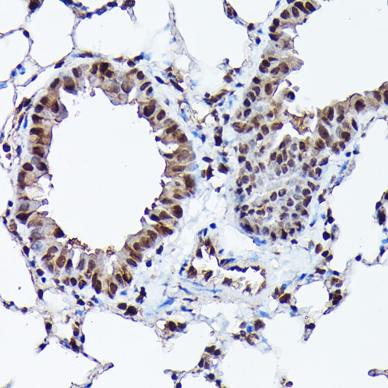 Immunohistochemistry - Anti-Ubiquitin Antibody [ARC50024] (A307666) - Antibodies.com