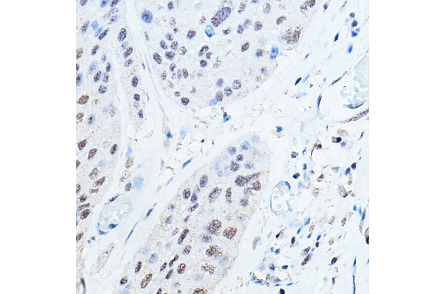 Immunohistochemistry - Anti-Ubiquitin Antibody (A307667) - Antibodies.com