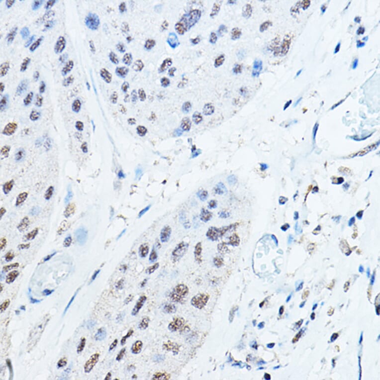 Immunohistochemistry - Anti-Ubiquitin Antibody (A307667) - Antibodies.com